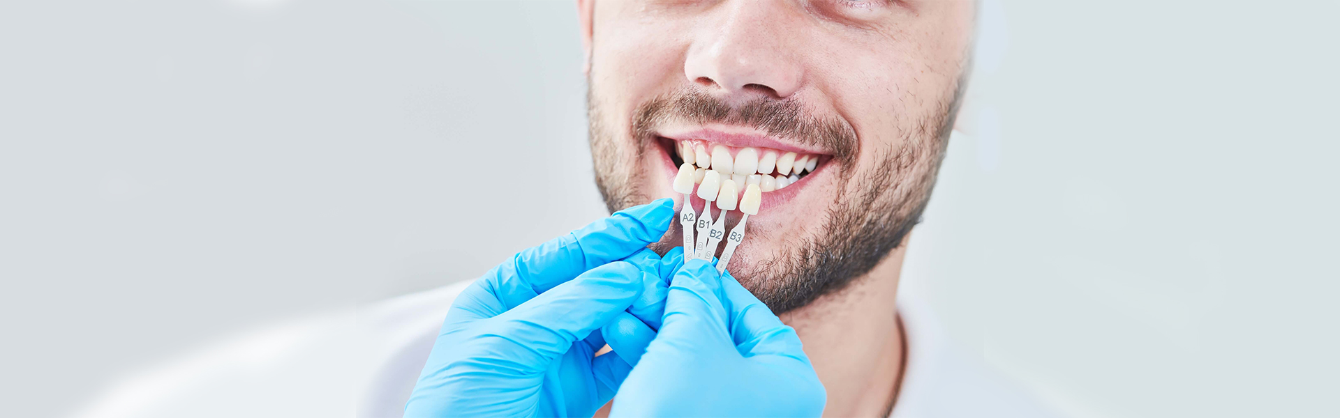 Revamp Your Dental Aesthetics Effectively Using Dental Veneers