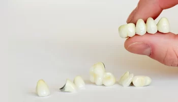 Different Types of Dental Crown Materials Explained