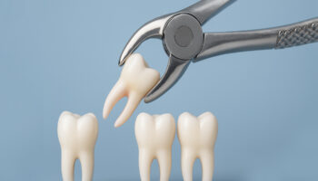 Tooth Extraction Aftercare: Important Things to Know