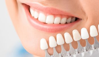 How Veneers Can Correct Chips, Stains, and Uneven Teeth