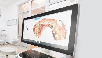 How Oral Cancer Screenings Help Detect Serious Health Risks Early
